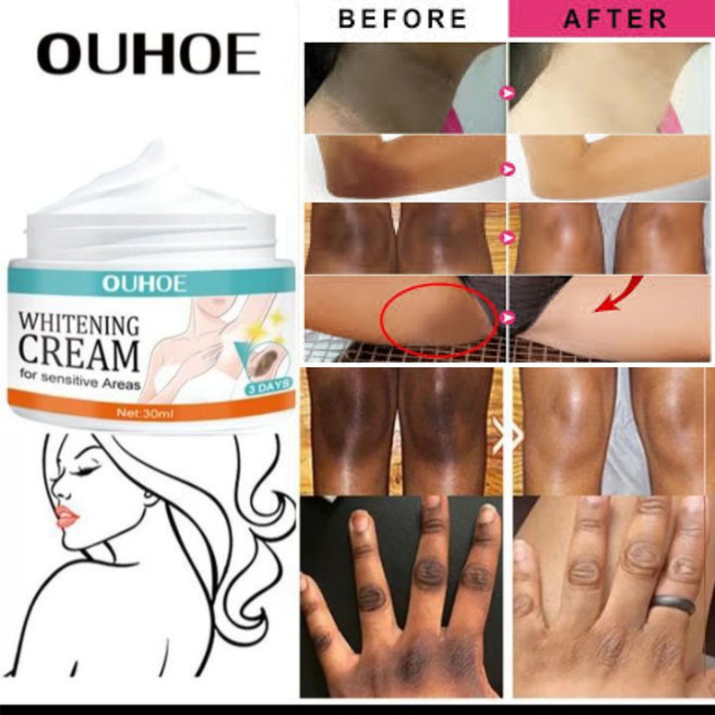 AVEESSENCE Whitening Cream for Men, Women and Girls