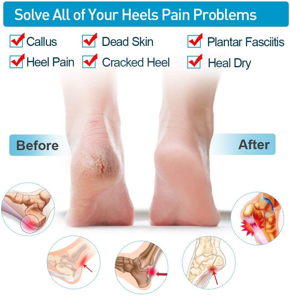 Silicone Gel Heel Pad Socks For Pain Relief And Anti Crack Heel 1 Pair Heel Cups Heel Guards Heel Protectors Heel Sleeves For Relieve Heel Pads Cushion Heel Pain, Heal Dry Cracked Heels, Achilles Tendinitis, For Men & Women