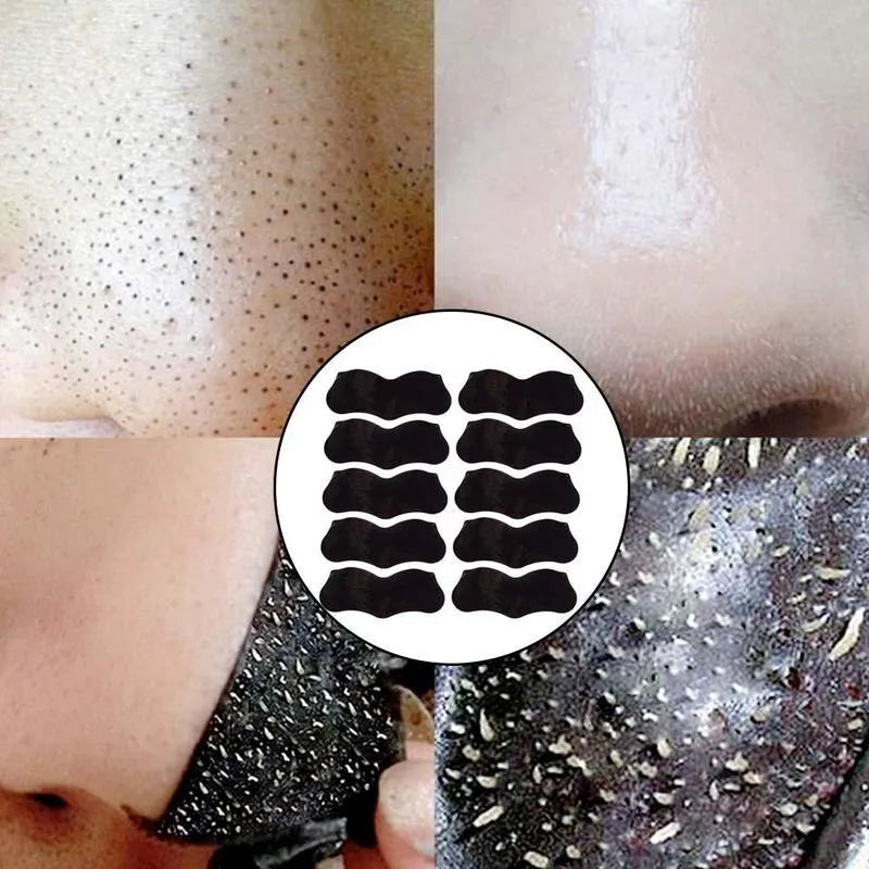 10pcs Nose Blackhead Remover Strips Mask Skin Care Shrink Pore Acne Treatment Mask Deep Nose Pore Cleansing Strips Black Head Remover