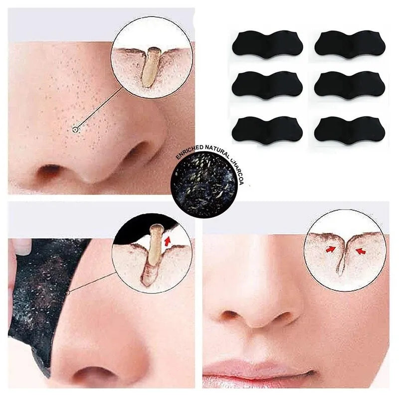 10pcs Nose Blackhead Remover Strips Mask Skin Care Shrink Pore Acne Treatment Mask Deep Nose Pore Cleansing Strips Black Head Remover
