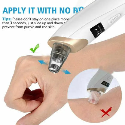 5 in 1 Electric Blackhead Acne Oil Remover Vacuum Suction Face Pore Cleaner Machine