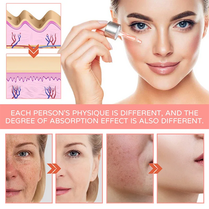 FORT 5 IN 1 Whitening Serum for Face - Anti-Aging, Dark Spot Correcting, and Whitening Serum for Glowing Skin | Glass Skin Care Products 30ML