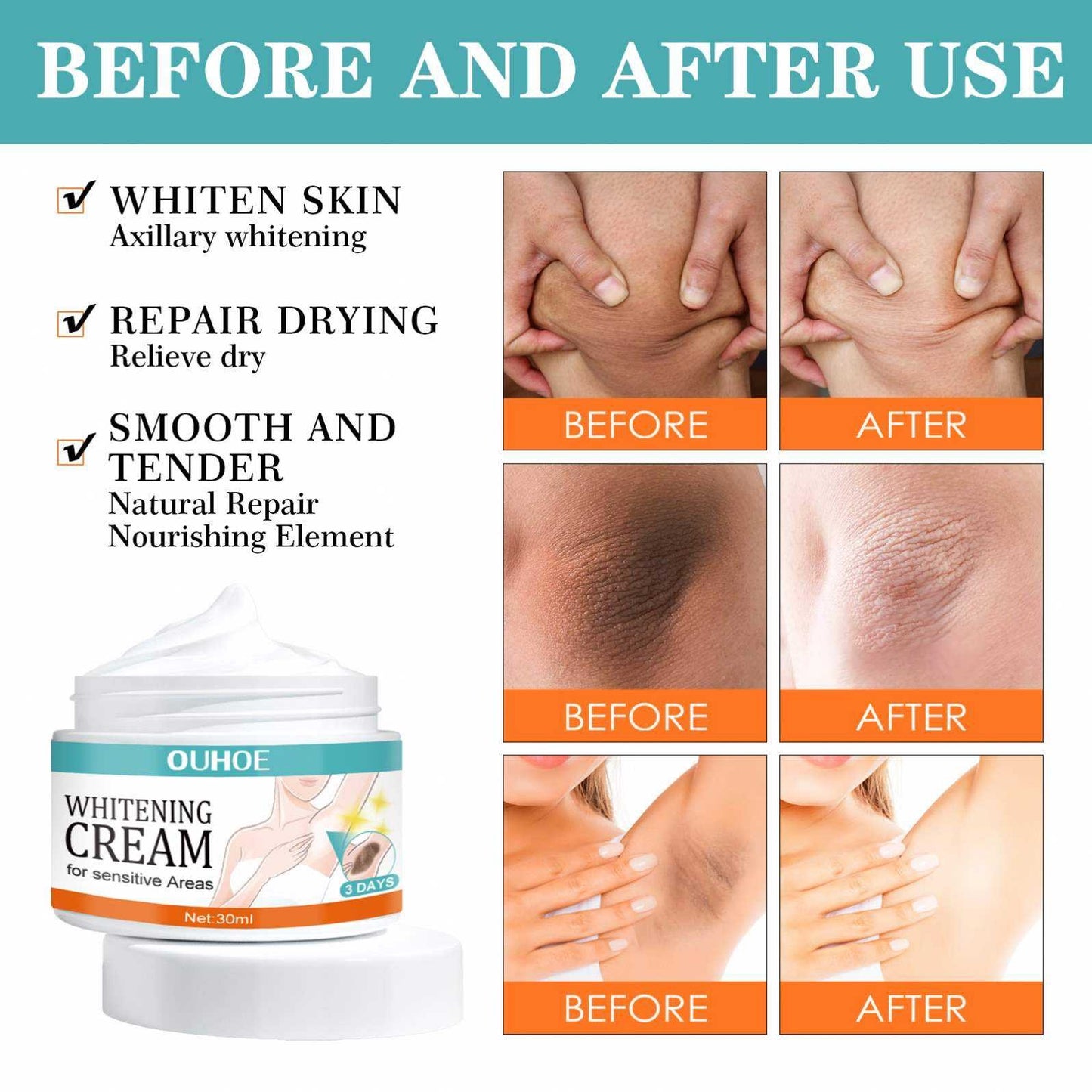 AVEESSENCE Whitening Cream for Men, Women and Girls